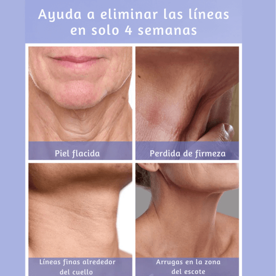 Crema de cuello reafirmante y recupérente - neck®