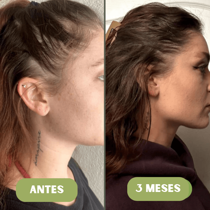 Aceite de crecimiento para el cabello Vitalis®