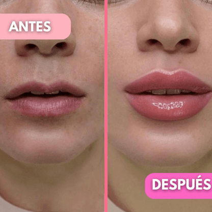 😍Pague 1 Lleve 2 🎁 Voluminizadores de Labios  Lip Extreme®💋