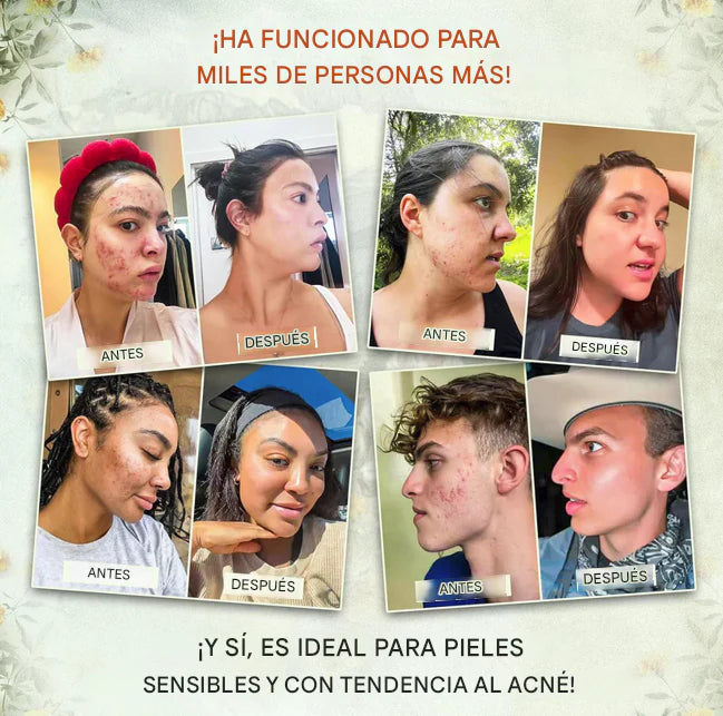Green Madame™ – Bálsamo antiarrugas con sebo y miel. Resultados visibles en 6 días.