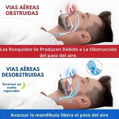 QuietX™ - Boquilla Antironquidos para Respirar Mejor y Dormir Tranquilo💤
