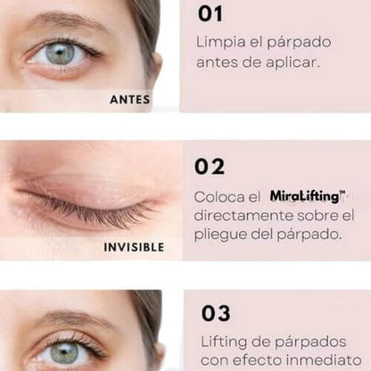 MiraLifting™||Realza tus parpados caídos y rejuvenece tu mirada