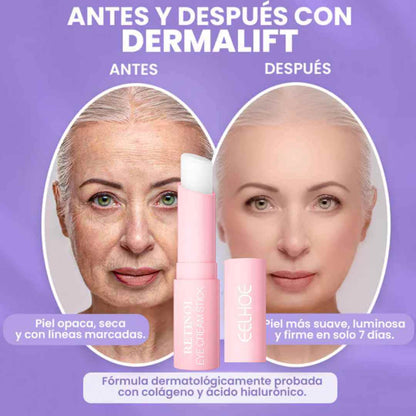 Dermalift™ – dile adiós a las arrugas y líneas de expresión en menos de 7 dias