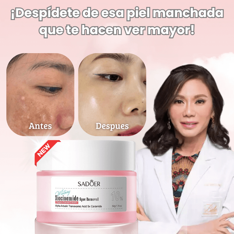 Crema Sadoer® - Despídete del melasma, pecas y manchas de la edad