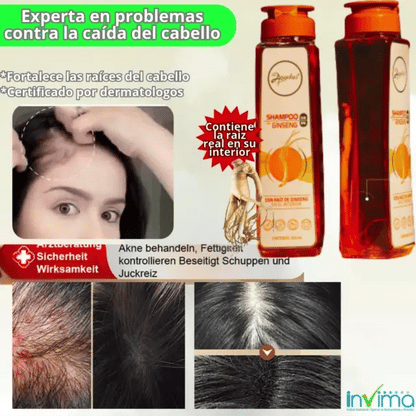 Shampoo con Ginseng – Detén la caída, fortalece tu cabello y dile adiós a la caspa💫