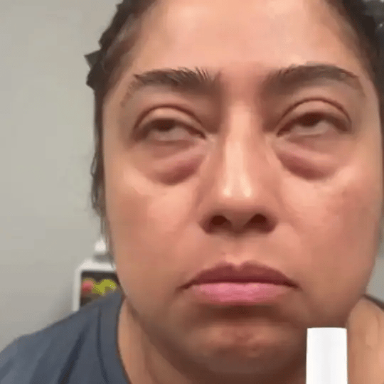 VC Luminosidad Instantánea con Vitamina C · Dolor vs. solución